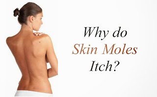 Skin Cancer Moles Types and Symptoms with Pictures