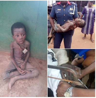 Little Boy Rescued After Being Chained In A Church In Ogun State For Weeks. Photos