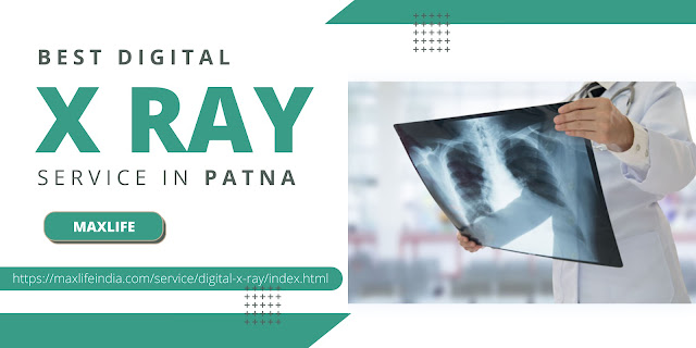 best digital X-Ray center Patna