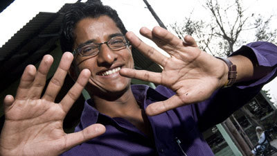 Extraordinary Indian Man With 12 Fingers 14 Toes