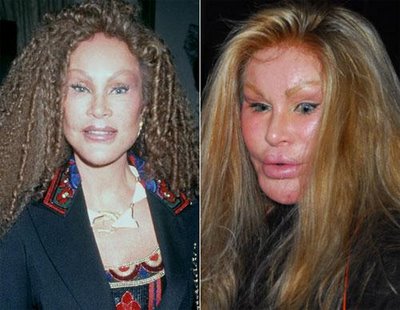 awful plastic surgery. Plastic Surgery