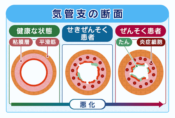 気管支の断面