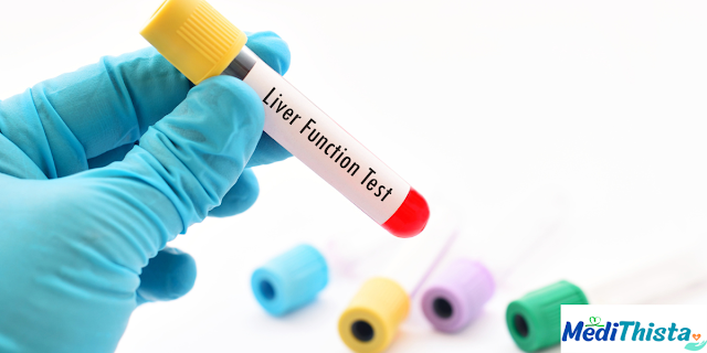 Understanding Hepatitis: Causes, Symptoms, and Treatment