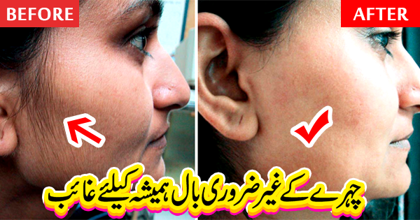 Remove Unwanted Hair from Face, Remove Unwanted Hairs from Face, facial hair removal for women, best facial hair removal, remove facial hair, 