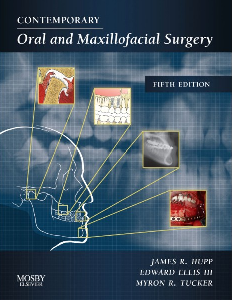 Contemporary Oral And Maxillofacial Surgery