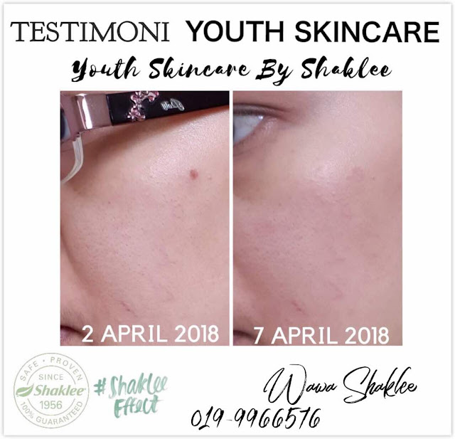 Testimoni Youth Skincare Shaklee, Youth Skincare, Youth Skincare Semulajadi