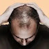 5 Meals That Prevents Hair Loss