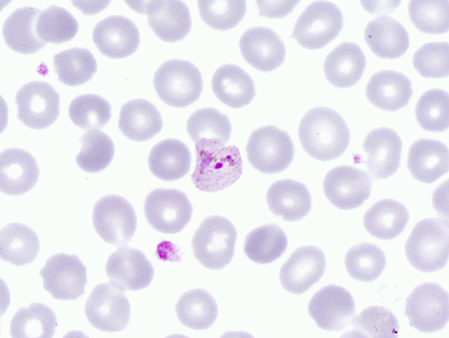 FIELD’S STAIN for malaria parasites