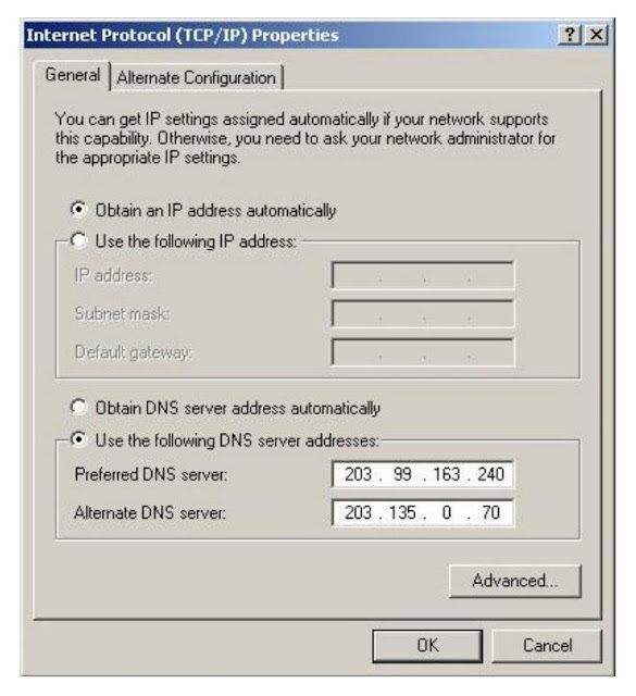 TCP IP Setting