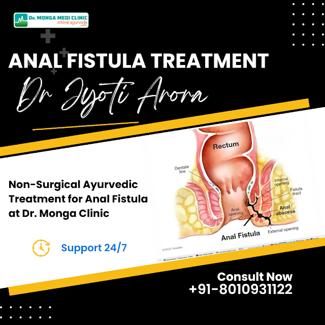 Best Non Surgical Anal Fistula Treatment