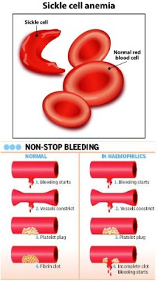 gene mutation