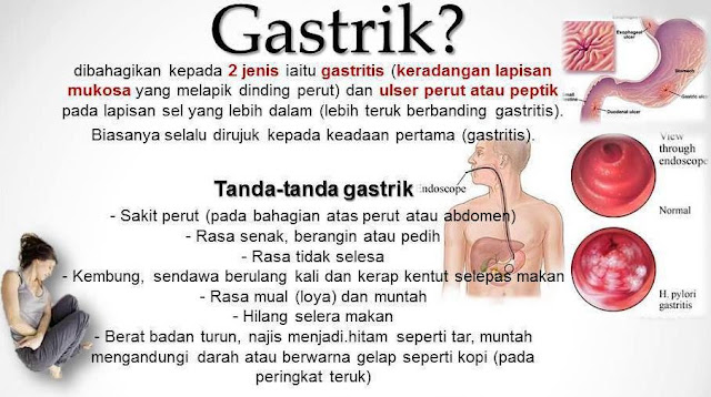 Anda Ada Gastrik Atau Pedih Ulu Hati Gout Atau Ada Gerd Atau Masalah Lebihan Asid Badan