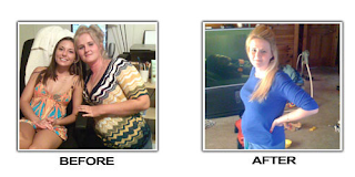 Amy uesd li shou slimming capsule Lost 73 Pounds