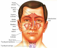 Penyakit Sinusitis