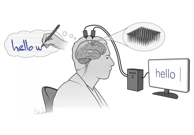 رقاقة الدماغ تسمح للإنسان المشلول بالكتابة