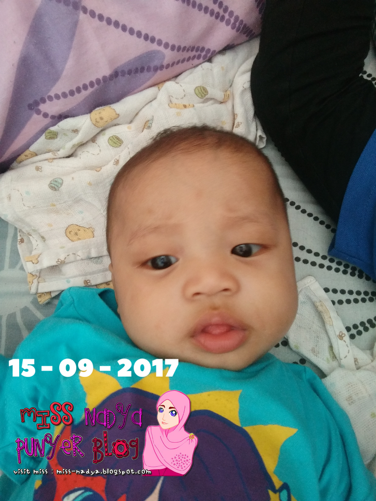 MISS NADYA: Kerak di Kepala Bayi Teruk