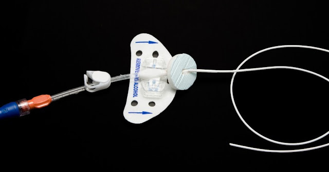 Indwelling catheters