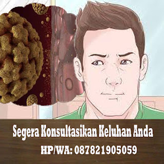 Obat Kutil Kelamin