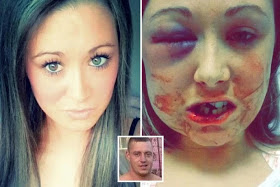 HORROR!! Young Mum Battered By Boyfriend For Rufusing To Have S*x With Him (PHOTOS)