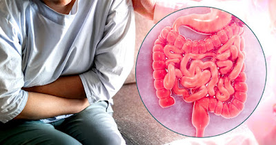 What are the signs and symptoms of chronic inflammatory bowel disease?