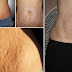 Remove Stretch Marks Easily By Using These Home Methods!