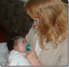 b4 surgery 006