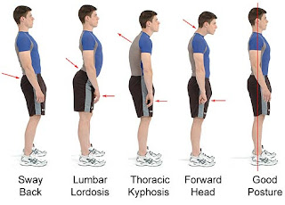 Make your Posture Right