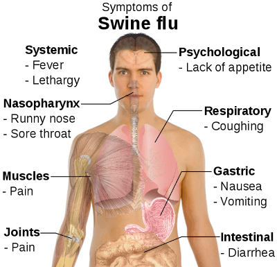 Gejala utama virus flu babi pada manusia