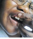 Makoti allegedly moered Mother In-Law, knocking out her front tooth!