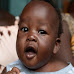 ONU: el mundo se enfrenta a un brote de hepatitis "de origen desconocido" que afecta a los niños