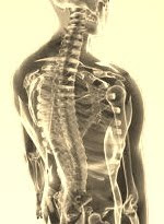 Indonesia Scoliosis Center membantu mengatasi permasalahan tulang belakang Anda.