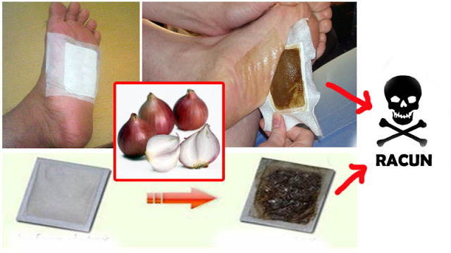 Cara Paling Ampuh Buang Semua Racun Dalam Tubuh