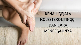 Gejala kolesterol tinggi