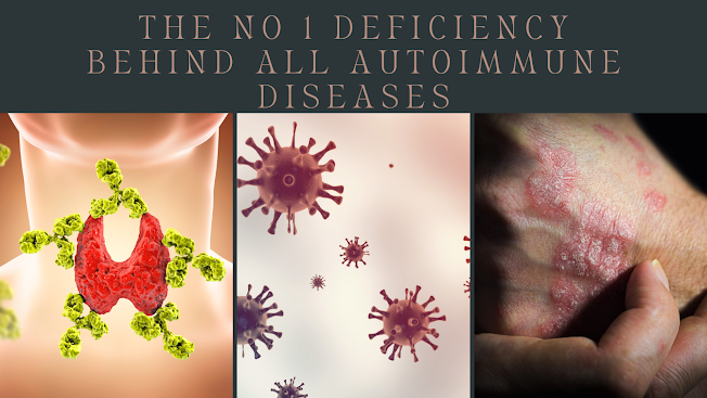 hashimoto, lupus symptoms, sjogren's syndrome, lupus disease, antiphospholipid syndrome, autoimmune encephalitis, myasthenia gravis symptoms, pemphigus, crest syndrome, selena gomez lupus, autoimmune disease symptoms
