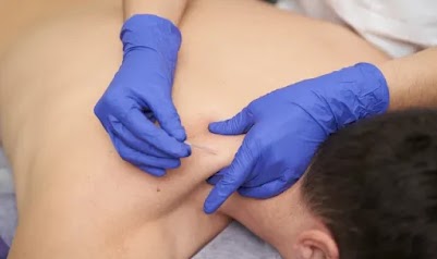 What Happens When Dry Needling Hits A Nerve