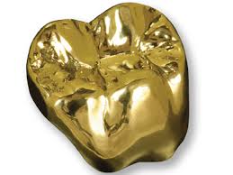 The gaining popularity of Gold crowns in dentistry… 