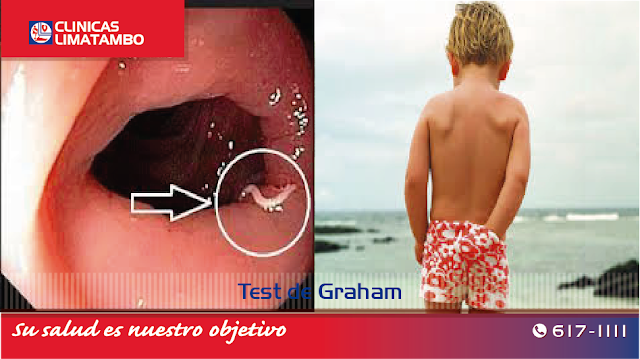 Test de Graham