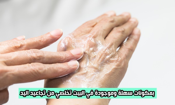 بمكونات سهلة وموجودة في البيت تخلصي من تجاعيد اليد وفتحي بشرتك