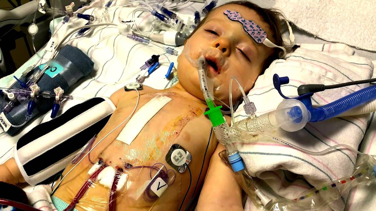 Open Heart Surgery Child