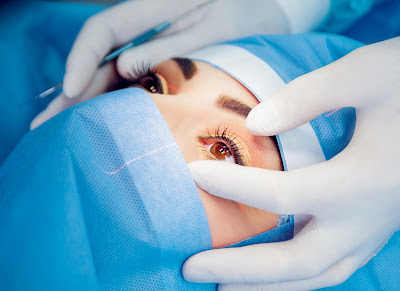 Ocular surgery, also known as eye surgery, is surgery performed on the eye or its adnexa by an ophthalmologist.