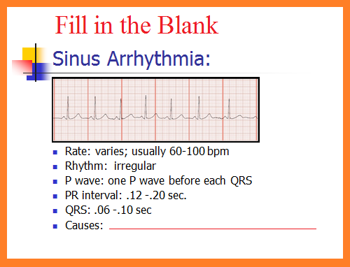 Telemetry Technician Course Sinus Rhythm Questions Class 5