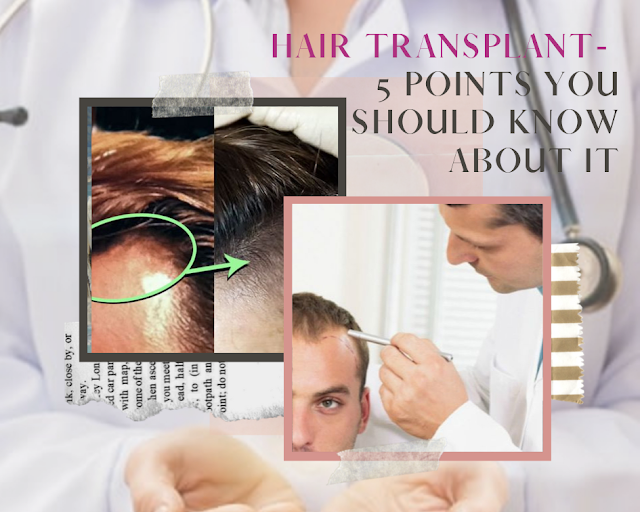 Hair Transplant in Indore, Hair Transplant Cost in Indore