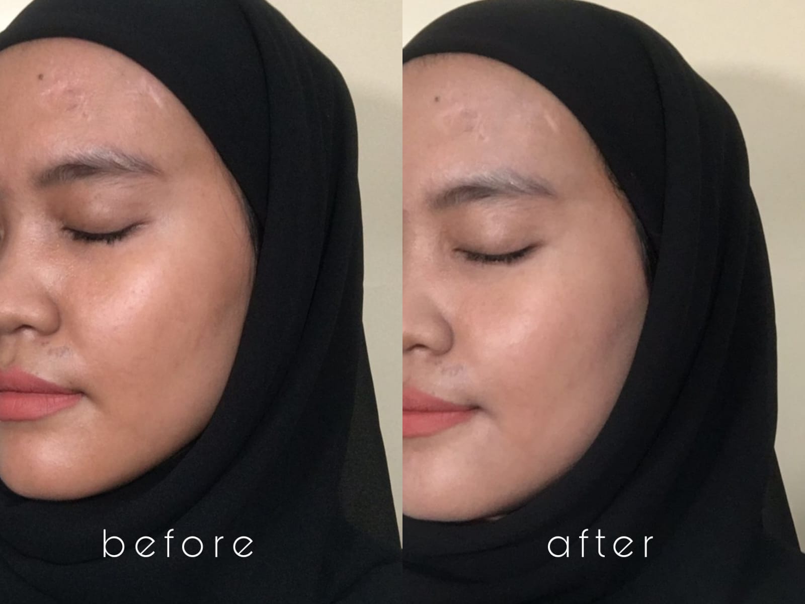 before after andayani rhani