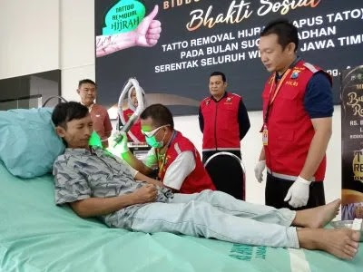 Polda Jatim Gelar Program Hapus Tato Gratis, Warga Antusias Mendaftar