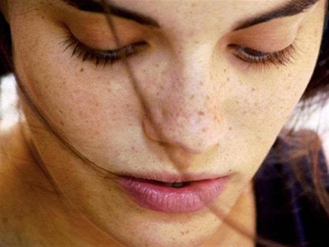 How To Remove Dark Spots From The Face Naturally