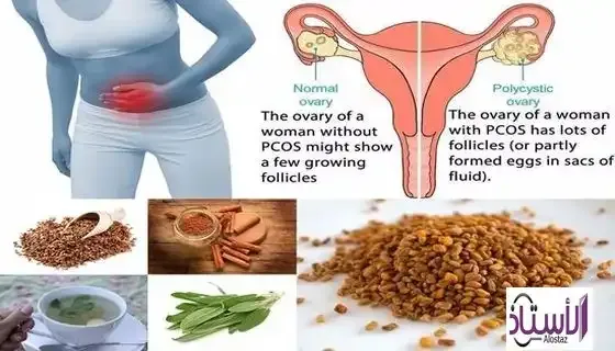 Herbs-to-treat-polycystic-ovaries