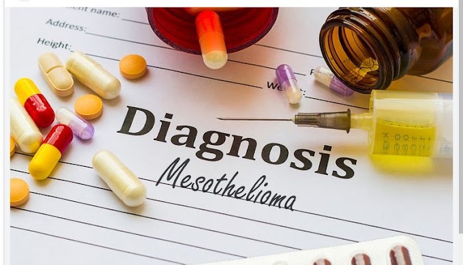 Mesothelioma - How It's Diagnosed