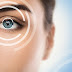 Facts About LASIK Eye Surgery