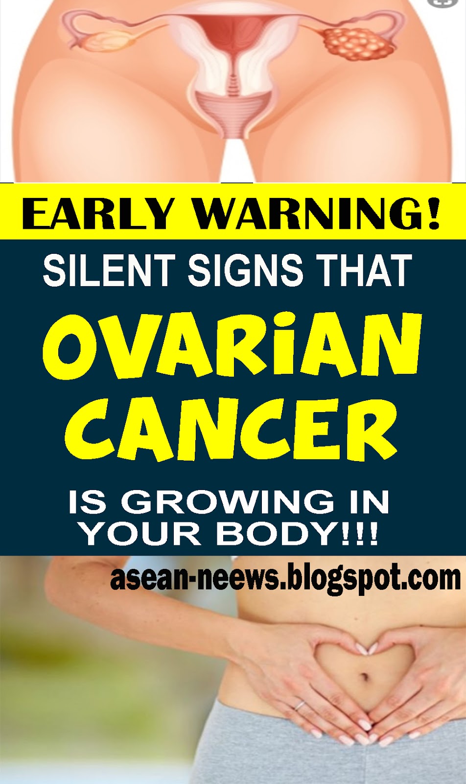 7 Signs Of Ovarian Cancer You Might Be Ignoring - Fitness Motivation