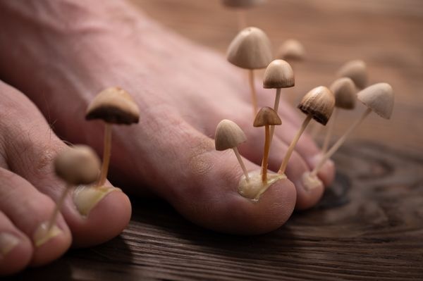 toenail fungus treatment manuals really help